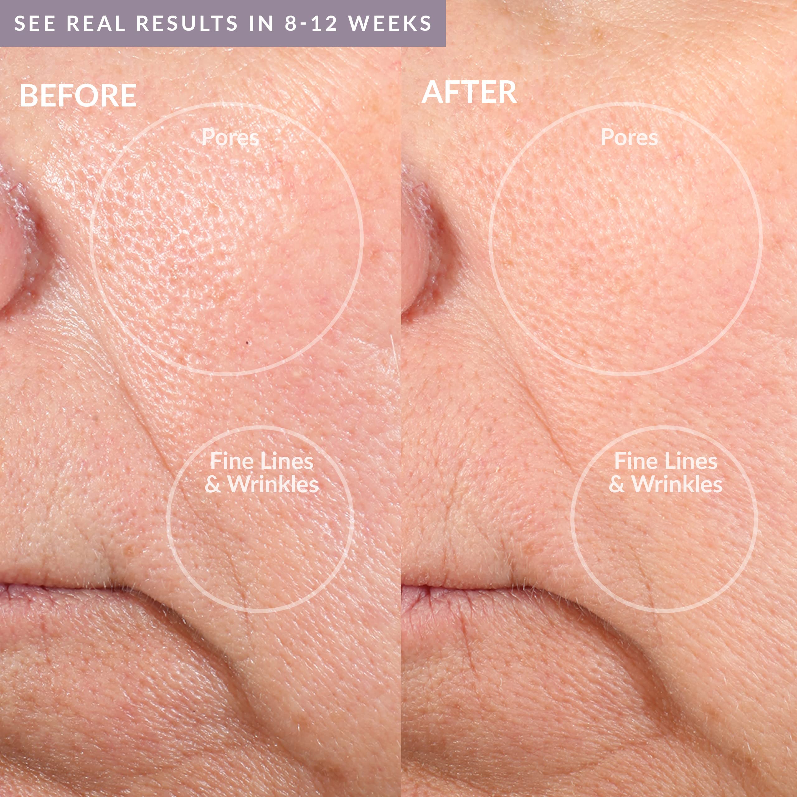 PMD Personal Microderm Pro - At-Home Microdermabrasion Machine with Kit for Face & Body - Exfoliating Crystals and Vacuum Suction for Fresh and Radiant Skin - High & Low Speed Options